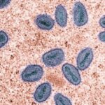 Patógenos. Viruela del mono o viruela símica. La OMS ha calificado a este patógeno como prioridad alta.