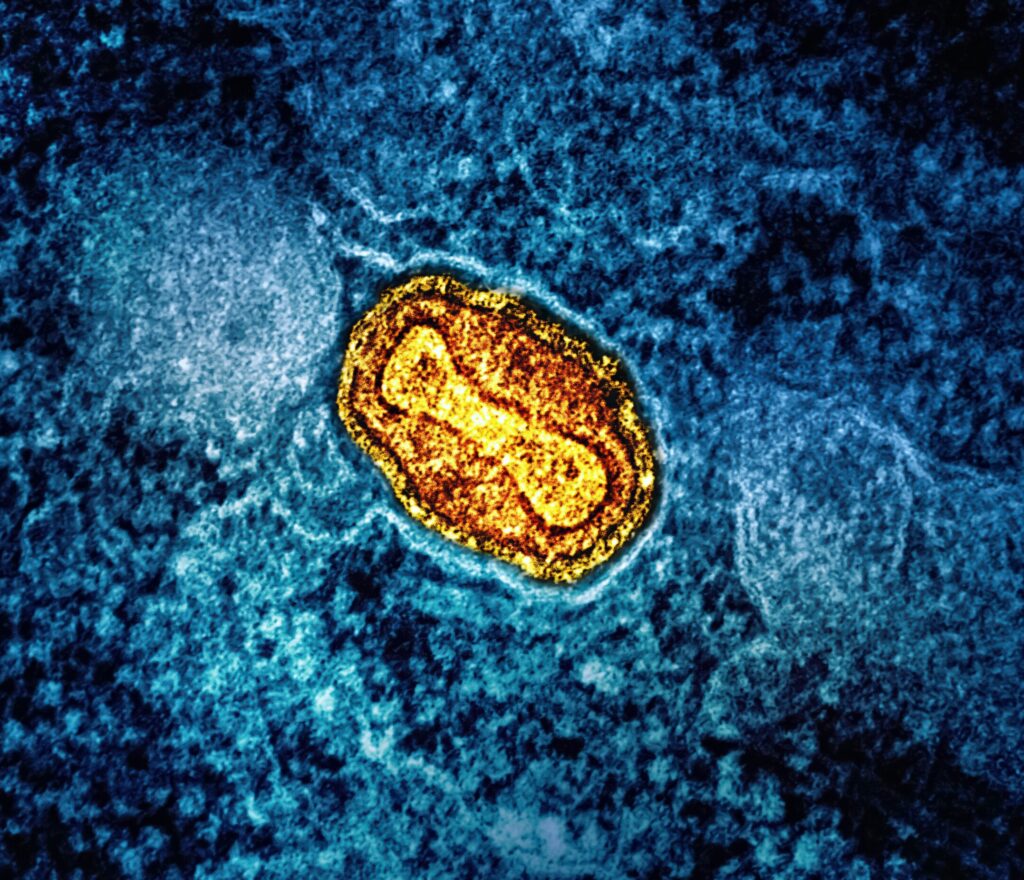 Patógenos: Fotografía coloreada de microscopio electrónico de un virión de viruela. Un virión es la partícula vírica morfológicamente completa e infecciosa.